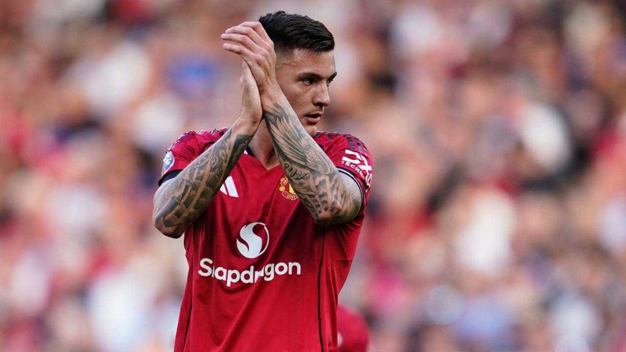 Manchester United: Benjamin Sesko Cedera, Amorim Ungkap Kondisi Terkini