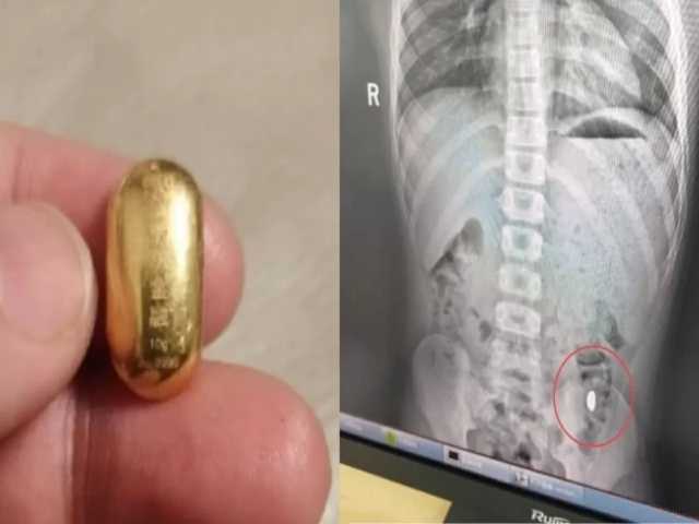 Search image article