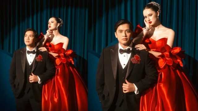 Billy Syahputra dan Vika Kolesnaya Umumkan Kehamilan Anak Pertama, Pamer Foto USG