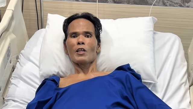 Fahmi Bo Sukses Jalani Operasi Empedu, Kondisi Terkini Diungkap