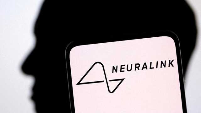 Neuralink Elon Musk: 12 Orang Telah Terima Implan Chip Otak